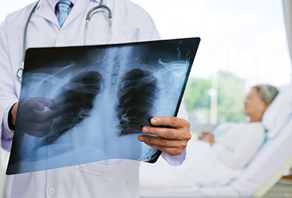 nhung benh nguoi cao tuoi thuong mac