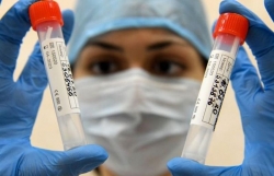 Nga sẽ tiêm phổ cập vaccine chống Covid-19 từ tháng 10