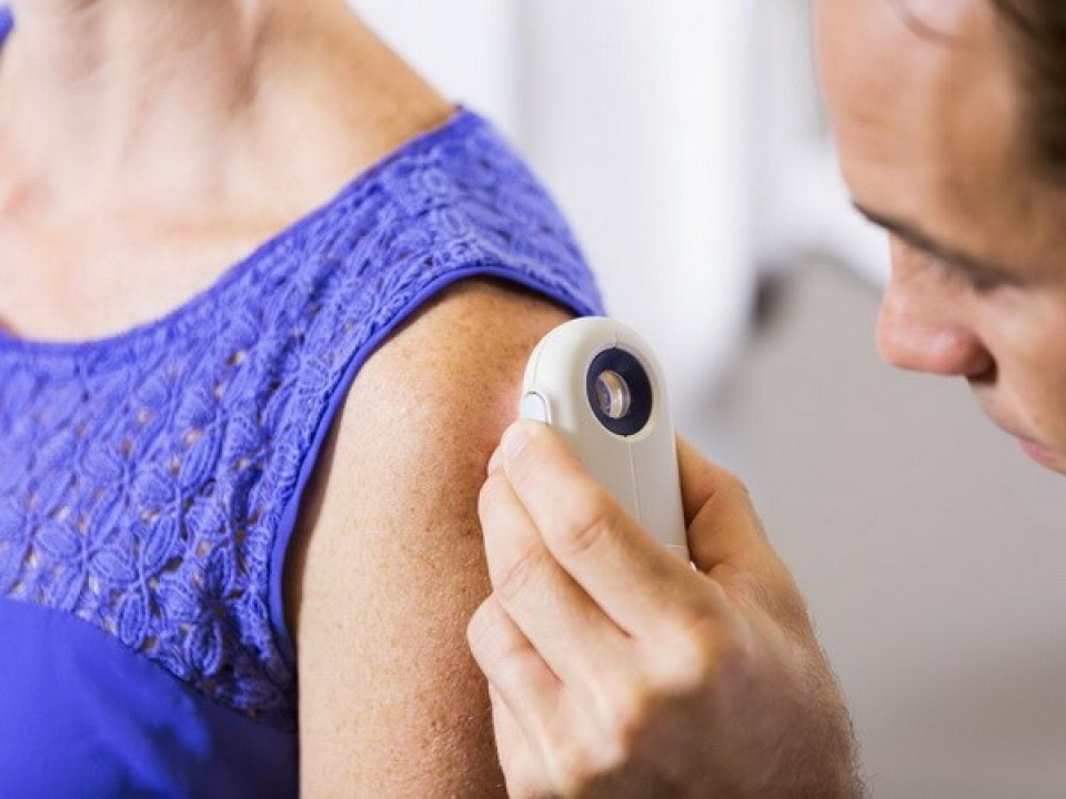 australia tim ra lieu phap ngan chan ung thu da