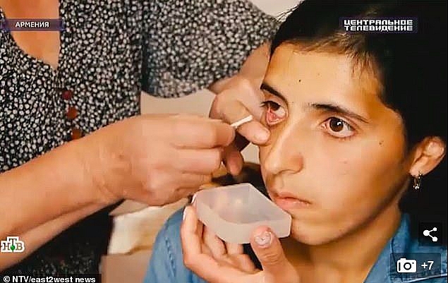 nghi ngo hien tuong co gai khoc ra pha le