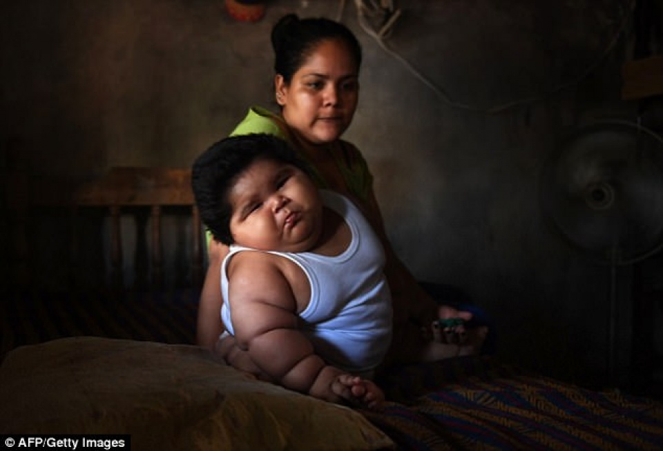 cau be 10 thang tuoi nang gan 30kg