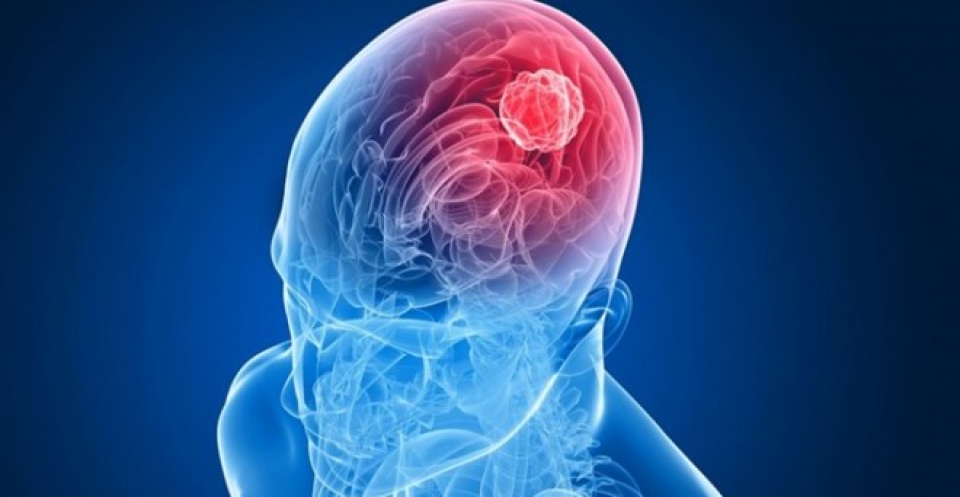 tin hieu vui cho nhung benh nhan dang dieu tri ung thu nao ac tinh