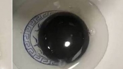 Trung Quốc: Chưa thể lý giải quả trứng ngỗng có lòng đen thay vì lòng đỏ