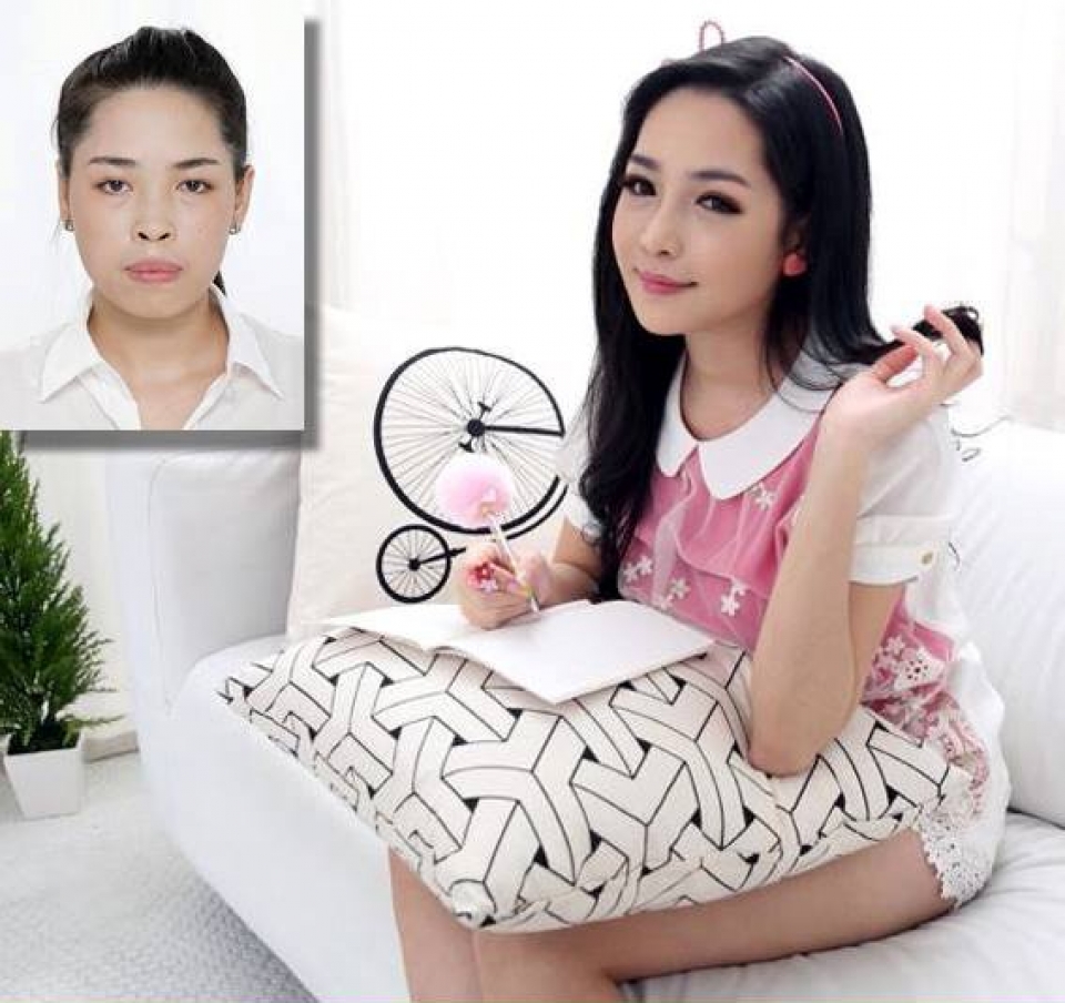 thay doi cuoc song cho cac ban tre co khiem khuyet ve ngoai hinh