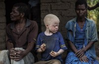 rua bach tang voi trai tim ngoai long nguc sieu hiem van song sot ki dieu