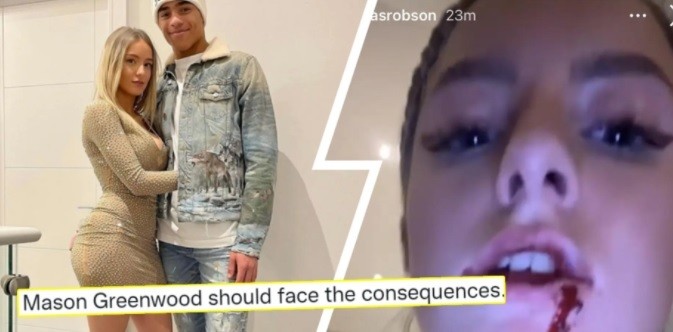 Manchester United: Tài năng trẻ Mason Greenwood bị bắt Manchester United: Tài năng trẻ Mason Greenwood bị bắt