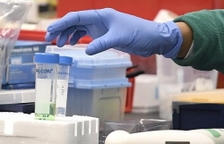 Triều tiên tuyên bố đang thử nghiệm vaccine phòng covid-19, không có bất cứ ca nhiễm sars-cov-2 nào