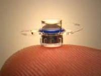 ca cay ghep tay o tre em dau tien tren the gioi thanh cong