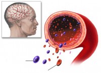 xem tivi co lien quan toi dau vung that lung o nu gioi