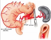 phat trien thanh cong he thong phat hien som ung thu da