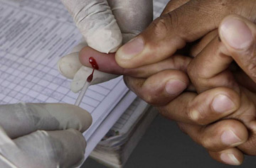 who keu goi su dung thuoc dieu tri hiv som