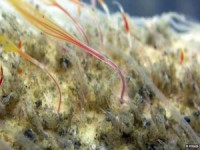 thanh nien o yen bai nhiem giun dai toi 60cm o bap tay