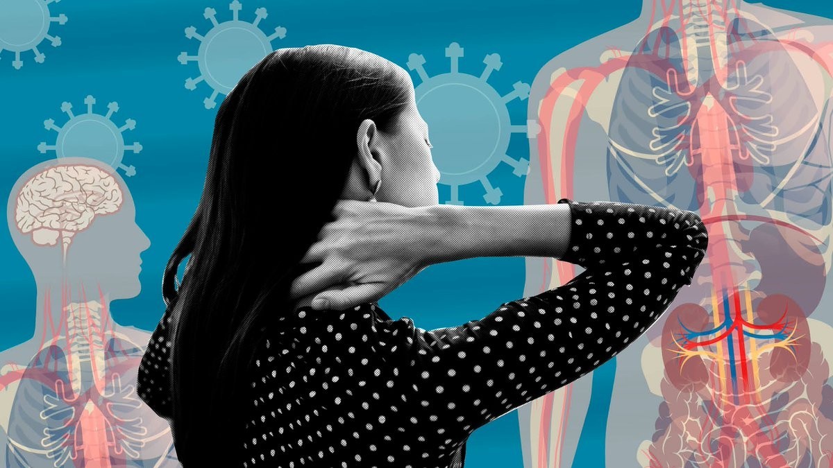 6 trieu chung tram cam hau covid19 de bi bo sot