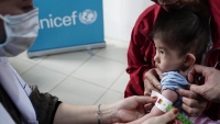 Trưởng đại diện UNICEF: Đưa điều trị suy dinh dưỡng cấp tính vào luật, Việt Nam sẽ cứu sống khoảng 230.000 trẻ em hàng năm