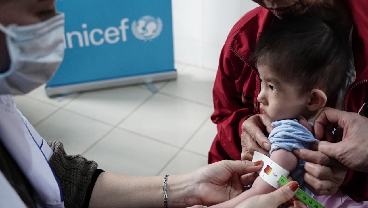 UNICEF kêu gọi các quốc gia tăng cường chính sách dinh dưỡng và tích hợp điều trị suy dinh dưỡng cấp tính ở trẻ em vào các chương trình y tế và ngân sách phát triển dài hạn. (Nguồn: UNICEF) UNICEF kêu gọi các quốc gia tăng cường chính sách dinh dưỡng và tích hợp điều trị suy dinh dưỡng cấp tính ở trẻ em vào các chương trình y tế và ngân sách phát triển dài hạn. (Nguồn: UNICEF)