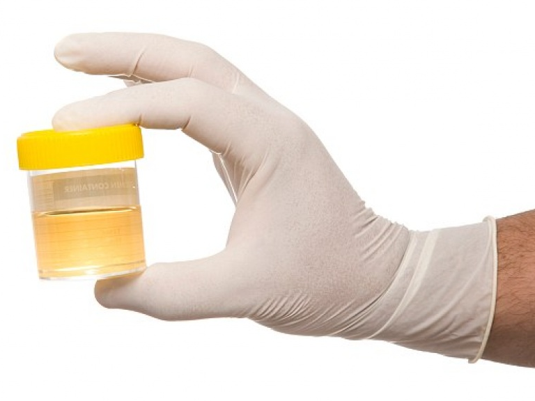 Xét nghiệm bệnh thận giúp cảnh báo nguy cơ sa sút trí tuệ