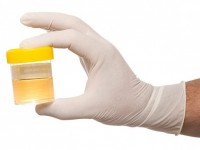 my benh nhan xin duoc cam tim minh lan cuoi