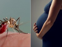 Mỹ: Phát hiện thêm trẻ sơ sinh bị dị tật do virus Zika