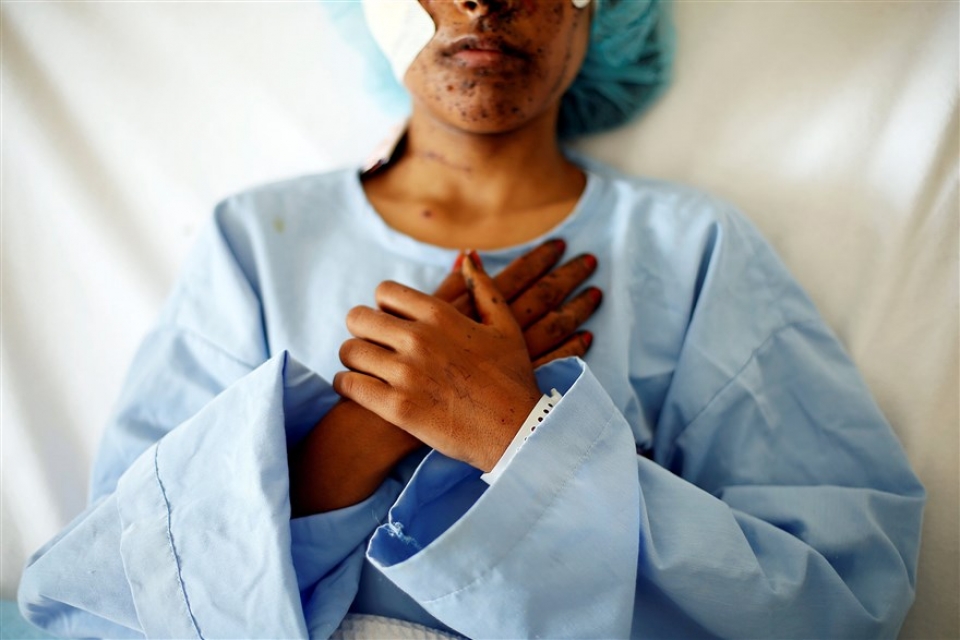 su kien trong tuan qua anh 9 163 be boi sang chanh o trieu tien