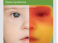 mac benh hiem chang trai 25 tuoi song trong hinh hai cau be tuoi 12