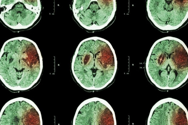 nguy co dot quy do quy uoc gio mua he