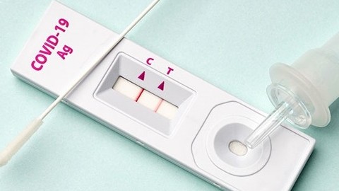 vi sao dan ong co nguy co tu vong vi covid19 cao hon phu nu