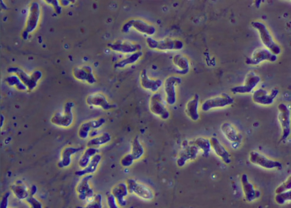 che tao thanh cong vaccine phong benh amip