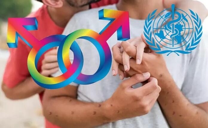 Bệnh đậu mùa khỉ: Ai dễ nhiễm và dễ bị bệnh nặng?